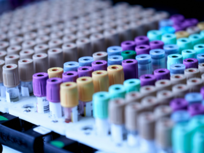 Saini Diagnostics